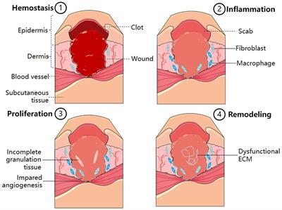 Mechanism and application of fibrous proteins in diabetic wound healing: a literature review